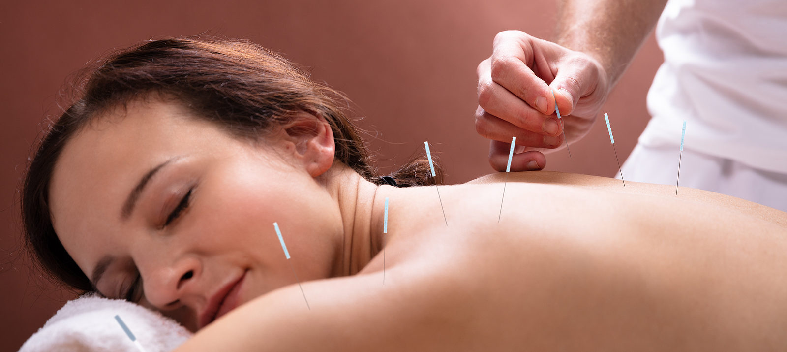 Now Offering Acupuncture