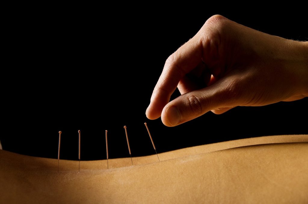 6 Ways Acupuncture Boosts Fertility Total Body Chiropractic