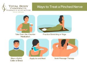 An infographic depicting 5 ways to treat a pinched nerve with exercise, medication, applying ice and heat and seeking massage therapy.