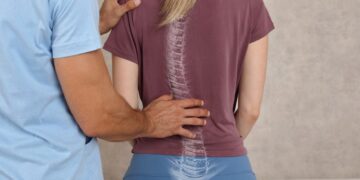 A woman is examined by a chiropractor for scoliosis of the spine.