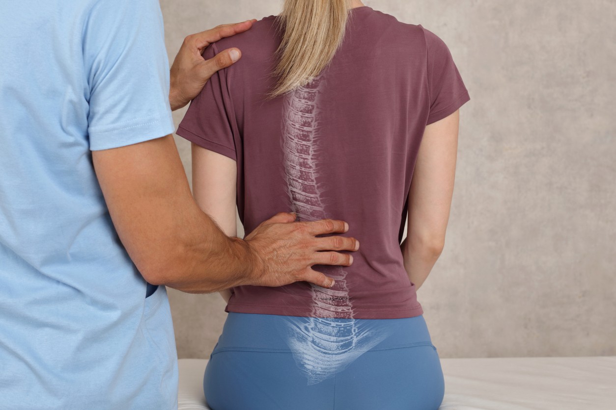 A woman is examined by a chiropractor for scoliosis of the spine.